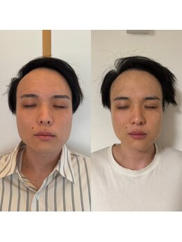 こうぞう整体院/美容鍼×筋膜リリース