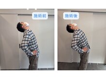 リライフ(ReLIFE)の雰囲気（BeforeAfter◎1度で効果実感出来ます！）