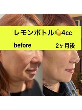 ララチッタ(L'la citta)/ララチッタでレモンボトル