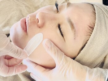 ソラナ(sorana)の写真/【期間限定】フェイシャルWAX脱毛＋毛穴洗浄が同時にできる！さらに光フェイシャルもセットでお得♪