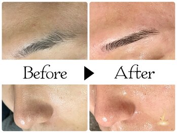 ルース(LUZ)/新郎様/ブライダルエステ/川口市