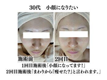 わ心美/ビフォーアフター