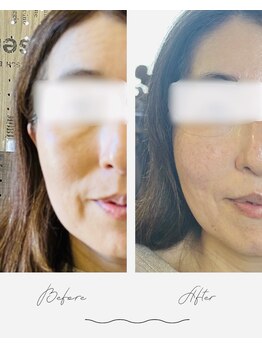 ナギスポット(Nagispot)/