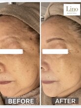 リノ 西宮北口店(Lino)/