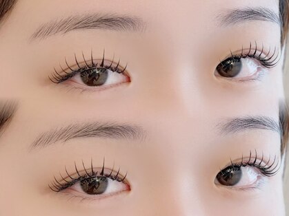 リリー(LILY)の写真