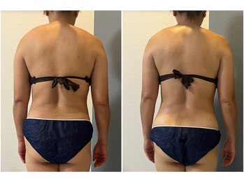 モア(moa)/腰回りもスッキリ