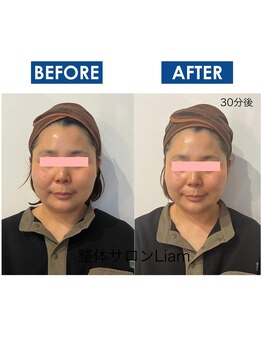 リアン(Liam)/小顔矯正/頭蓋骨矯正&美肌ケア