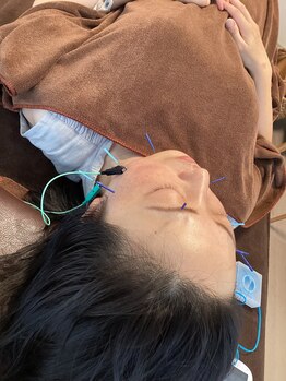 ハリファ鍼灸院 横浜関内院(HariFa鍼灸院)/美容施術