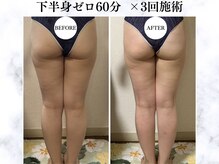 シーフェイス 横浜店(SEE FACE)/温活痩身下半身ゼロ 60分コース