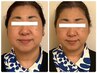 【たるみ改善】むくみにサヨナラ！スッキリ小顔に 30分　初回体験