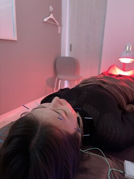 ハリファ鍼灸院 熊本院(HariFa鍼灸院)/美容鍼