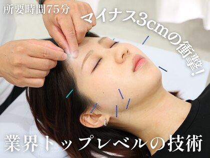 アロエ鍼灸整体院の写真