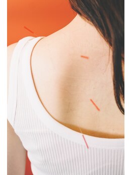 ハウ(How)/image ［岡山 整体 美容鍼］