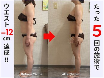 ぷりんす整体コージー(COZY)/【50代 女性】ビフォーアフター