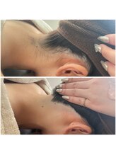 ミース 北九州店/うなじ◎ビフォーアフター