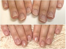 深爪矯正 爪悩み専門店 グラシナ 西宮北口店【4/3 NEW OPEN（予定）】/(深爪/長さだし/フィルイン)