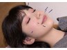 【学生割引/高校生・大学生】美容はり施術