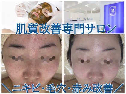 リンダ(Rinda)の写真