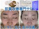 リンダ(Rinda)の写真
