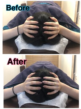 スカイ 鍼灸整骨院 整体院(SKY)/小顔矯正