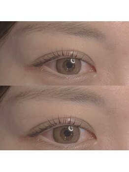 ジョリー(Jolie)/美容液を