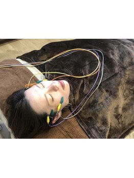 鍼灸施術を受けたい