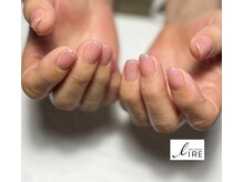 イーレ(IRE)/粘膜カラーとフラッシュ