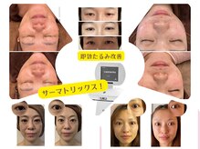 ラディアント たまプラーザの雰囲気（最新マシン【サーマトリックス】でたるみ改善！コラーゲン再構築）