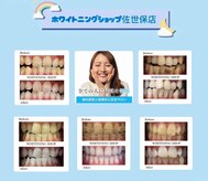 ホワイトニングショップ 佐世保店