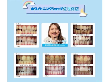 ホワイトニングショップ 佐世保店の写真
