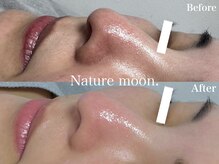 ナチュールムーン(Nature moon.)/毛穴洗浄