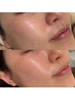 ラ クレール ビューティーサロン(LA CLAIR)/ホワイトラボ