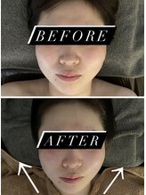 ユヴィラ(YUVIRA)/フェイシャルリンパでスッキリ♪