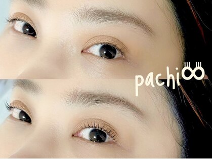 パチ(pachi)の写真