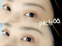 パチ(pachi)