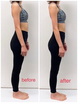 ブライダルエステ バイ スイスパ表参道(BRIDAL ESTHE by SUI SPA)/【骨盤矯正】痩身 Before→After