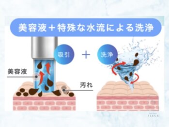フルール(FLEUR)/ハイドラ毛穴洗浄