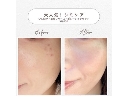 エムボーテ 太田店(M BEAUTE33)の写真