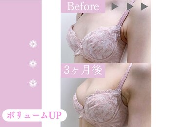 キアナ 横浜店(Kiana)/平均2～3カップUP続出