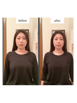 シナジェ 岡山店(Synergye)/ヘッドトリートメントで効果UP!