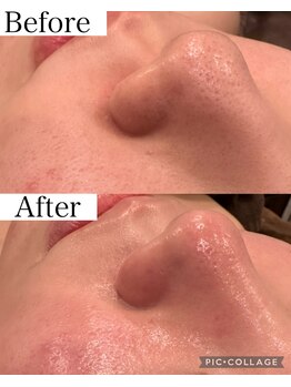 ウォーム(Warm)/20代女性の来店が増えています！