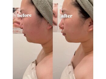 &still【アンドスティル】【4/1 NEW OPEN(予定)】 /【レモンボトル】