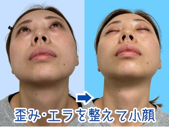 ナチュラルビューティーフェイス 横浜(NBF)/顎の歪み改善/横浜駅小顔矯正