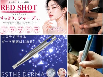 シュール(Sur)の写真