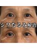 【目元の土台からじっくりケア】アイパワーエステ単品《初回》埼玉県初導入!!