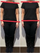 ブライダルエステ バイ スイスパ表参道(BRIDAL ESTHE by SUI SPA)/【骨盤矯正】歪み Before→After