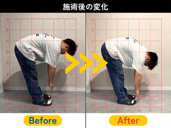 志村坂上駅前整骨院/☆ビフォーアフター例☆