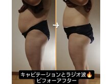 西院アロマリラクゼーションサロン シャルール/1回でもしっかり効果出します！