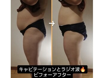 西院アロマリラクゼーションサロン シャルール/1回でもしっかり効果出します!