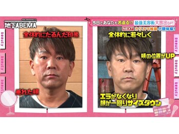 さつま骨格矯正 HRD広尾 西麻布院 /「ななに一地下ABEMA」に出演☆